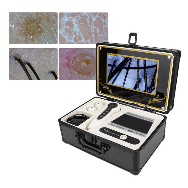 آنالیز پوست و مو (9 اینچ)